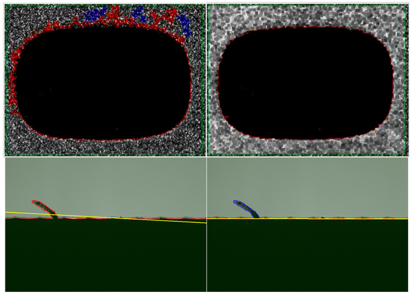 Processamento de imagens Werth - Análise perfeita de imagens para óptica e tomografia computadorizada